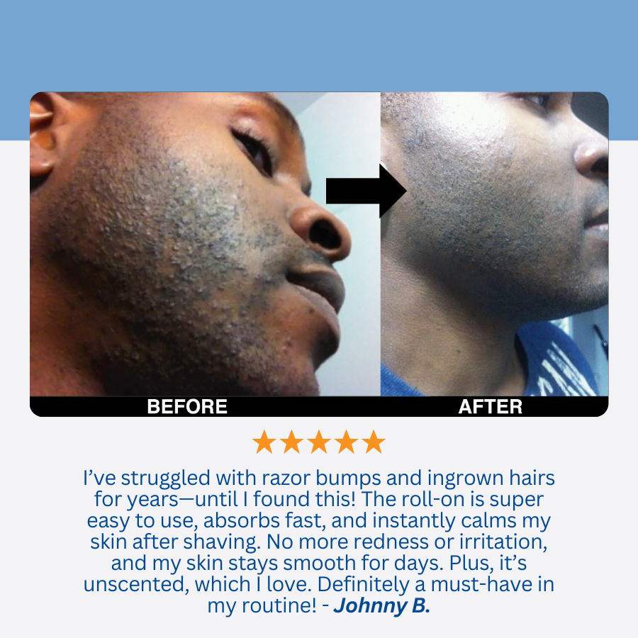 Soothing Hair Roll-on Serum